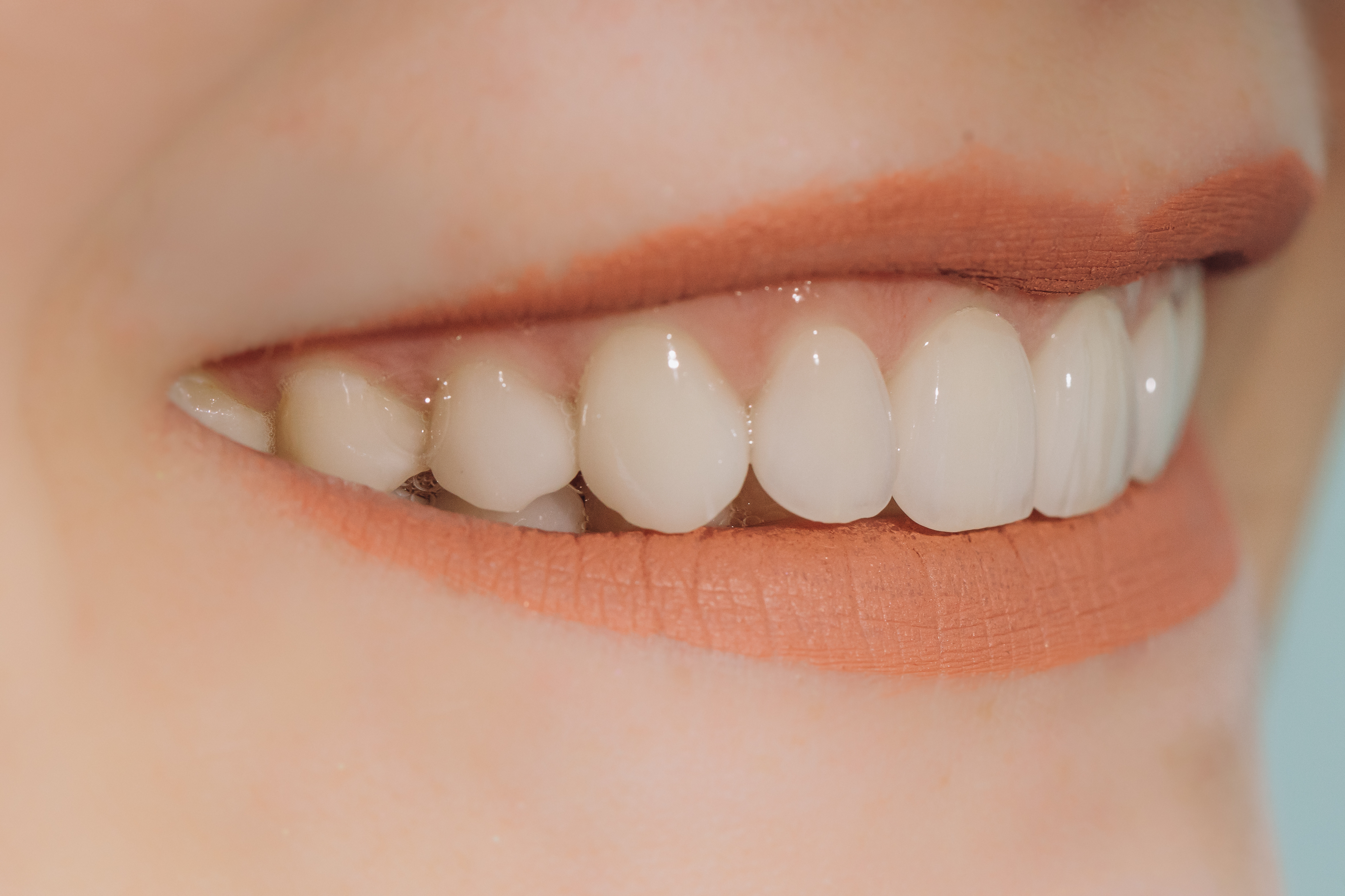 歯の色、形態、歯肉の調和が取れている